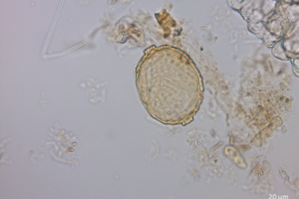 A magnified image of a small microorganism