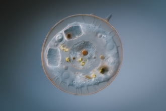 A scanning electron microscope image of a testate amoeba.