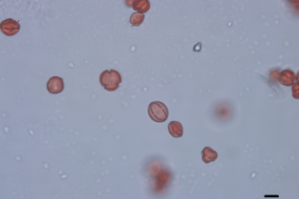 ollen grains of dropwort as seen under a light microscope