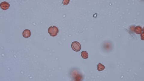ollen grains of dropwort as seen under a light microscope