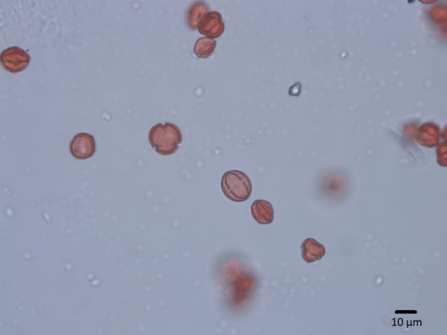 ollen grains of dropwort as seen under a light microscope