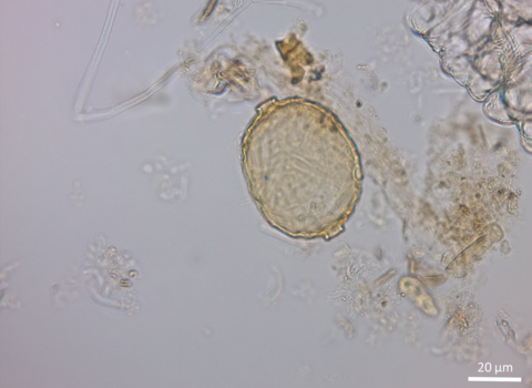 A magnified image of a small microorganism