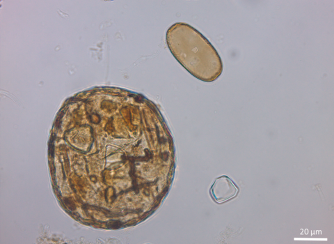 Two microorganisms - Trigonopyxis arcula to the left and Amphitrema flavum to the right