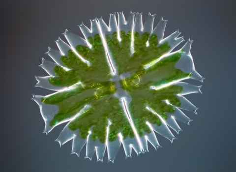 Desmid algae under the microscope